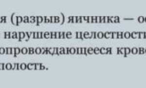 Все про апоплексию яичника