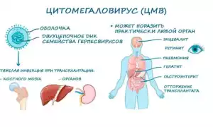 Цитомегалия: что это такое и как с этим бороться?