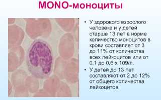 Пониженное абсолютное содержание моноцитов у мужчины