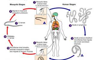 Что такое филярия: все, что вам нужно знать о редкой и опасной болезни