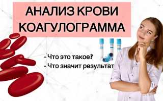 Коагулограмма крови у женщин после 50 — что нужно знать